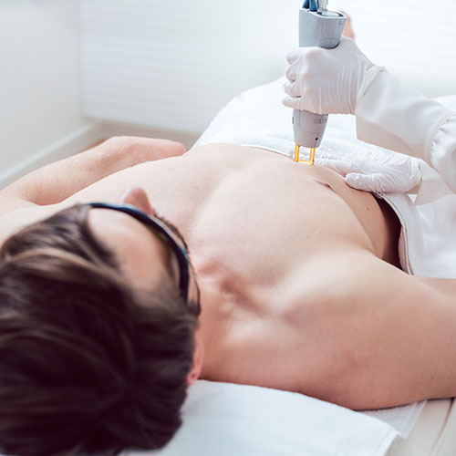 vegleges-szortelenites-ferfiaknak